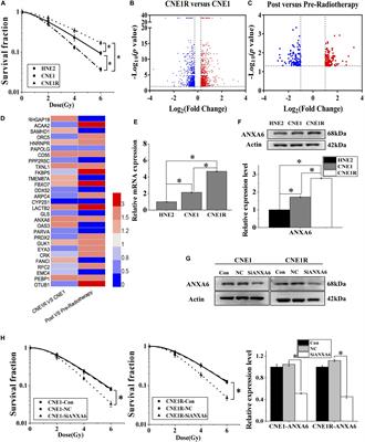 ANXA6 Contributes to Radioresistance by Promoting Autophagy via Inhibiting the PI3K/AKT/mTOR Signaling Pathway in Nasopharyngeal Carcinoma